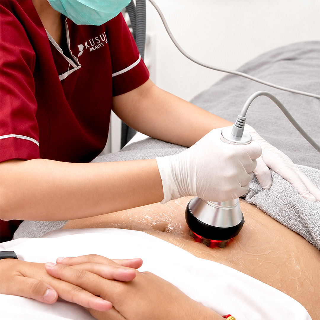 RF Treatment